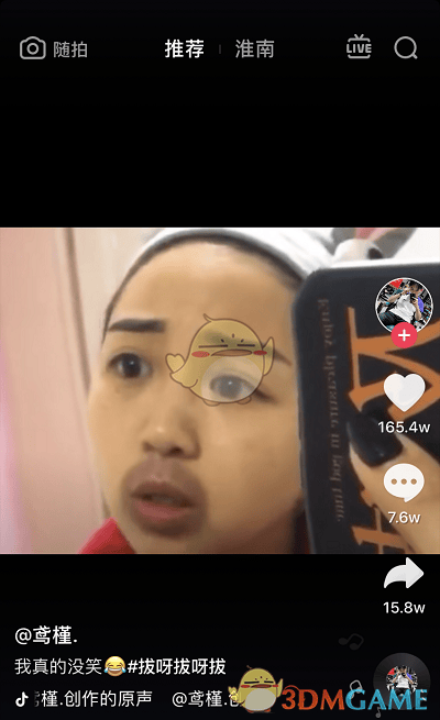 抖阴嘴上拔罐能治牙疼是什么梗 嘴上拔罐能治牙疼梗的原视频分享